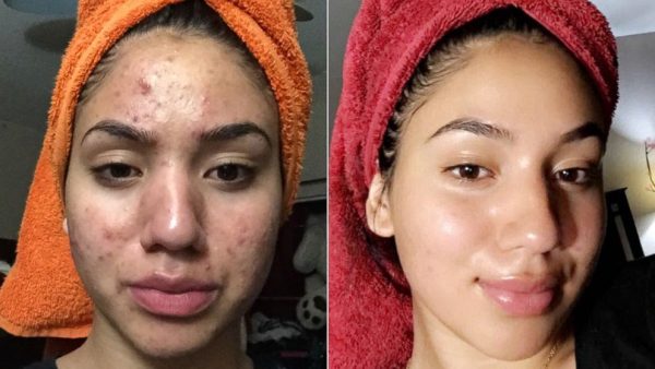 Skin Lightening Creams in Pretoria